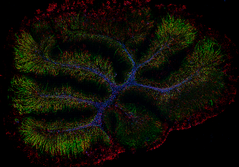 超快光學層切全景掃描系統