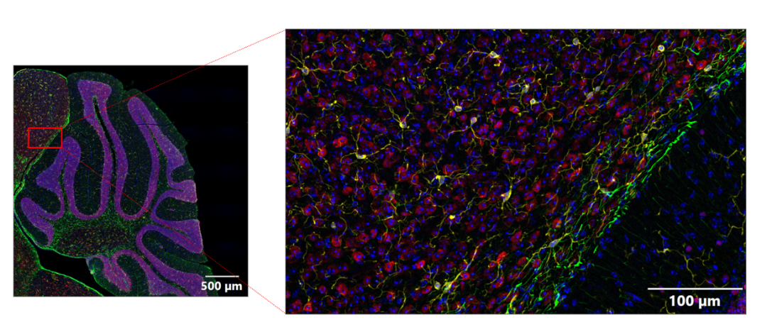 超快光學層切全景掃描系統