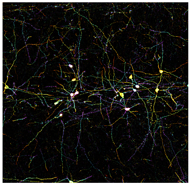 超快光學層切全景掃描系統