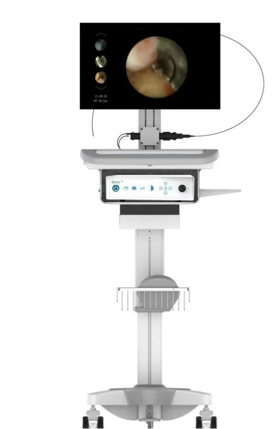 口腔内窥镜怎么用【口腔科普】牙周内窥镜：开启口腔健康的微观世界_https://www.jmylbn.com_新闻资讯_第3张