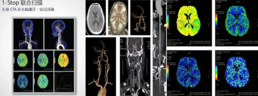 ge的ct有哪些型号影像科│引进GE Revolution 256排高端CT_https://www.jmylbn.com_新闻资讯_第8张