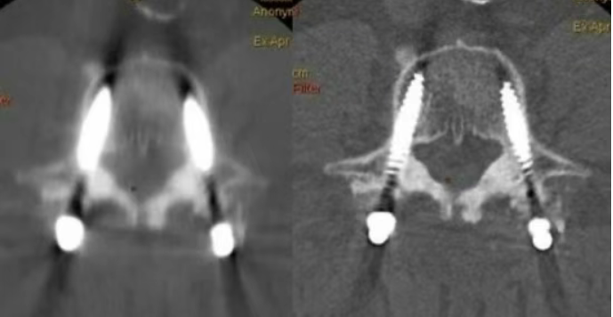 ge的ct有哪些型号影像科│引进GE Revolution 256排高端CT_https://www.jmylbn.com_新闻资讯_第17张