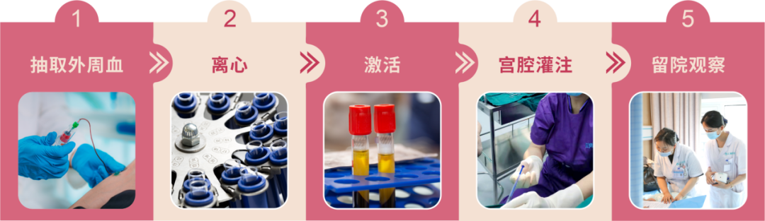 内膜薄？反复移植失败？试试这个“黑科技”！