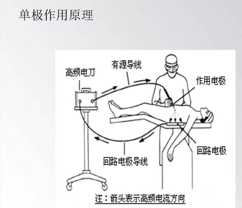 为什么手术用电刀手术中高频电刀的使用注意事项，保障手术安全！_https://www.jmylbn.com_新闻资讯_第5张