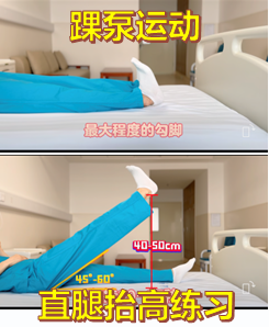 什么品牌的关节镜好改善护理服务行动｜新上加“心” 运动医学与关节镜科基于5E康复模式打造520+围手术期护理品牌_https://www.jmylbn.com_新闻资讯_第5张