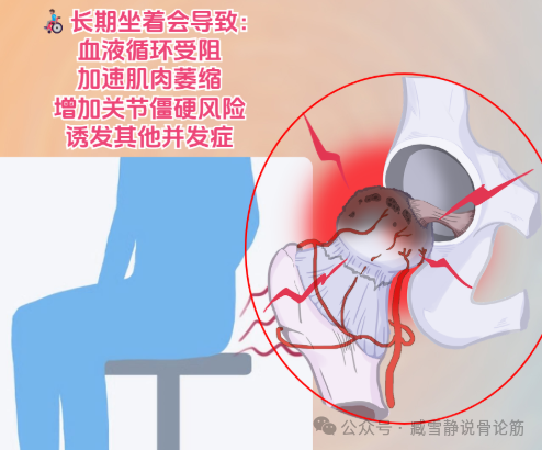 股骨头坏死方