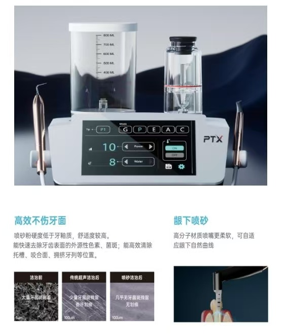 牙周治疗仪怎么做牙周超声喷砂牙周治疗仪，让您的牙齿更白更亮_https://www.jmylbn.com_新闻资讯_第7张