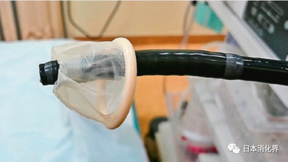 内镜异物钳有哪些内镜异物取出术：自制“好帮手”工具_https://www.jmylbn.com_新闻资讯_第3张