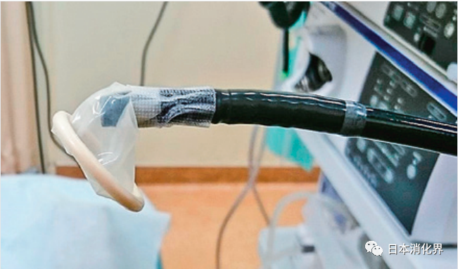 内镜异物钳有哪些内镜异物取出术：自制“好帮手”工具_https://www.jmylbn.com_新闻资讯_第2张