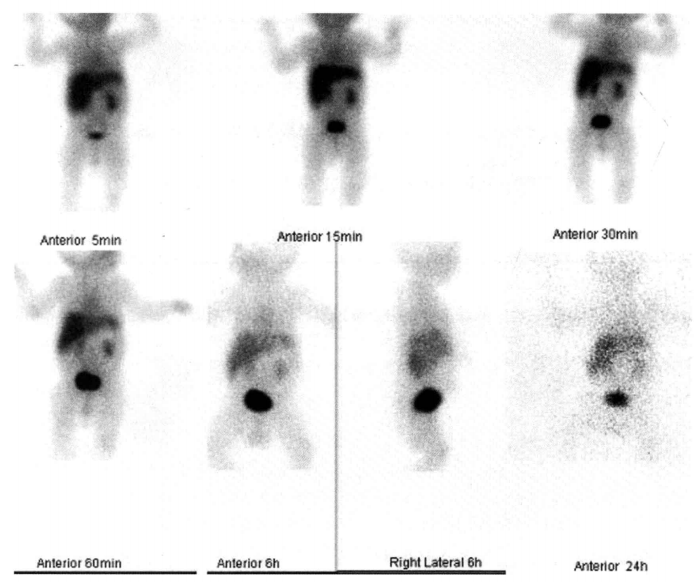 d-spect怎么检查SPECT／CT科普 ｜ 核医学不是 “可怕的核”！从检查到治疗，这些精准利器帮你对抗疾病_https://www.jmylbn.com_新闻资讯_第12张