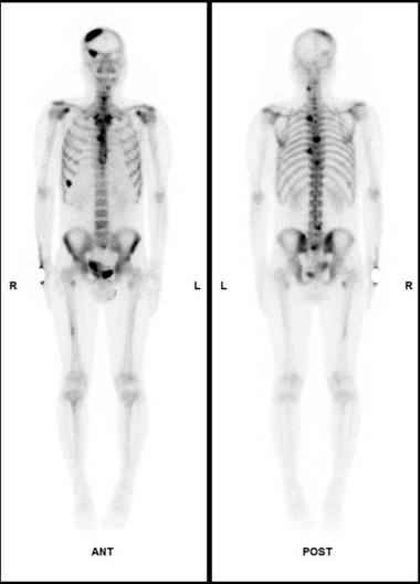 d-spect怎么检查SPECT／CT科普 ｜ 核医学不是 “可怕的核”！从检查到治疗，这些精准利器帮你对抗疾病_https://www.jmylbn.com_新闻资讯_第9张