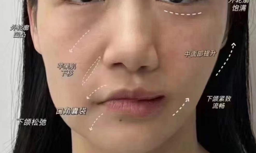 脸越补越肿?先看这几个高发区