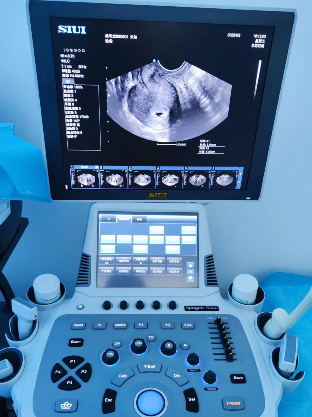 siui彩超怎么用【科室介绍】大宁县人民医院超声科_https://www.jmylbn.com_新闻资讯_第9张