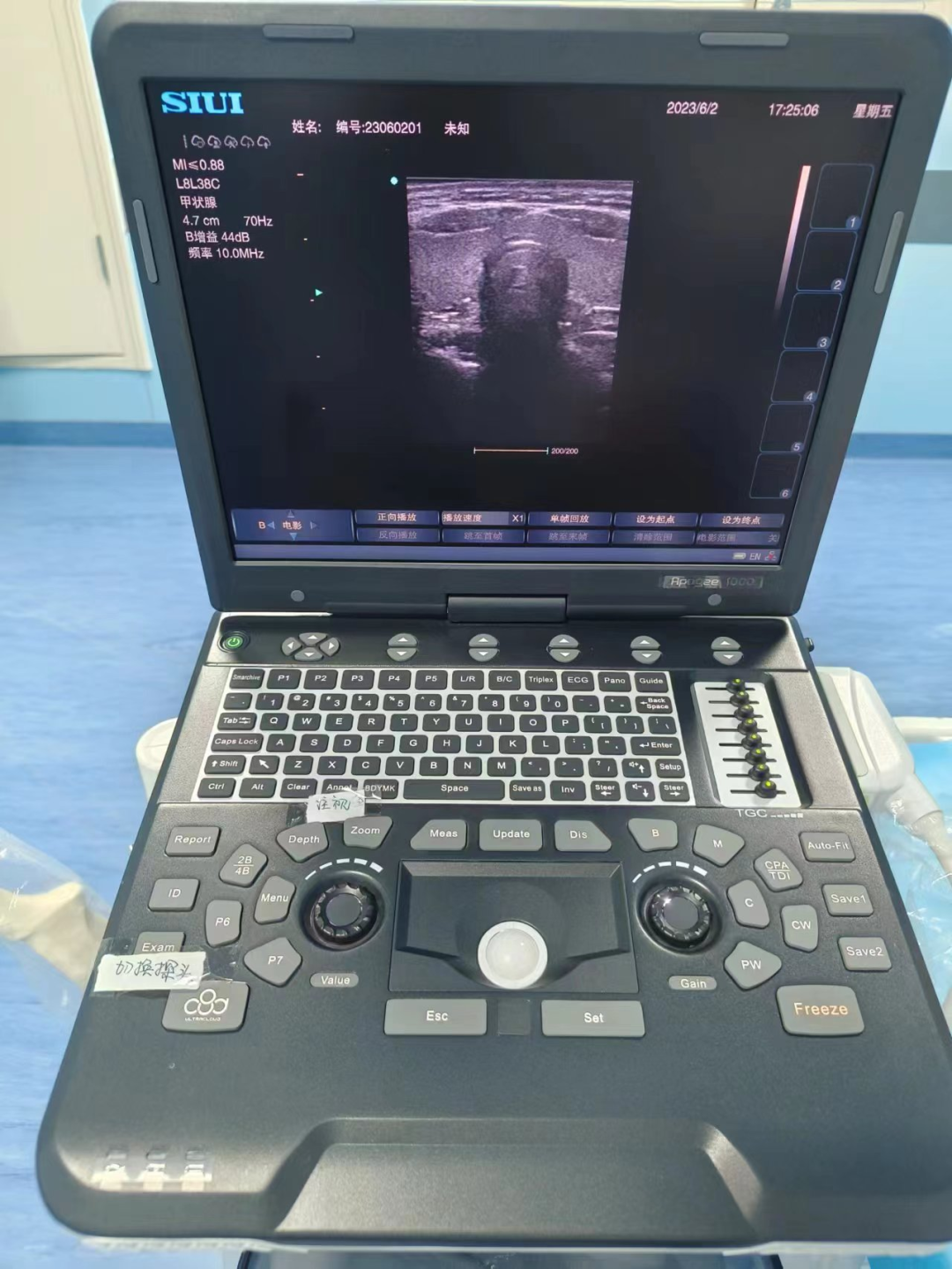 siui彩超怎么用【科室介绍】大宁县人民医院超声科_https://www.jmylbn.com_新闻资讯_第8张