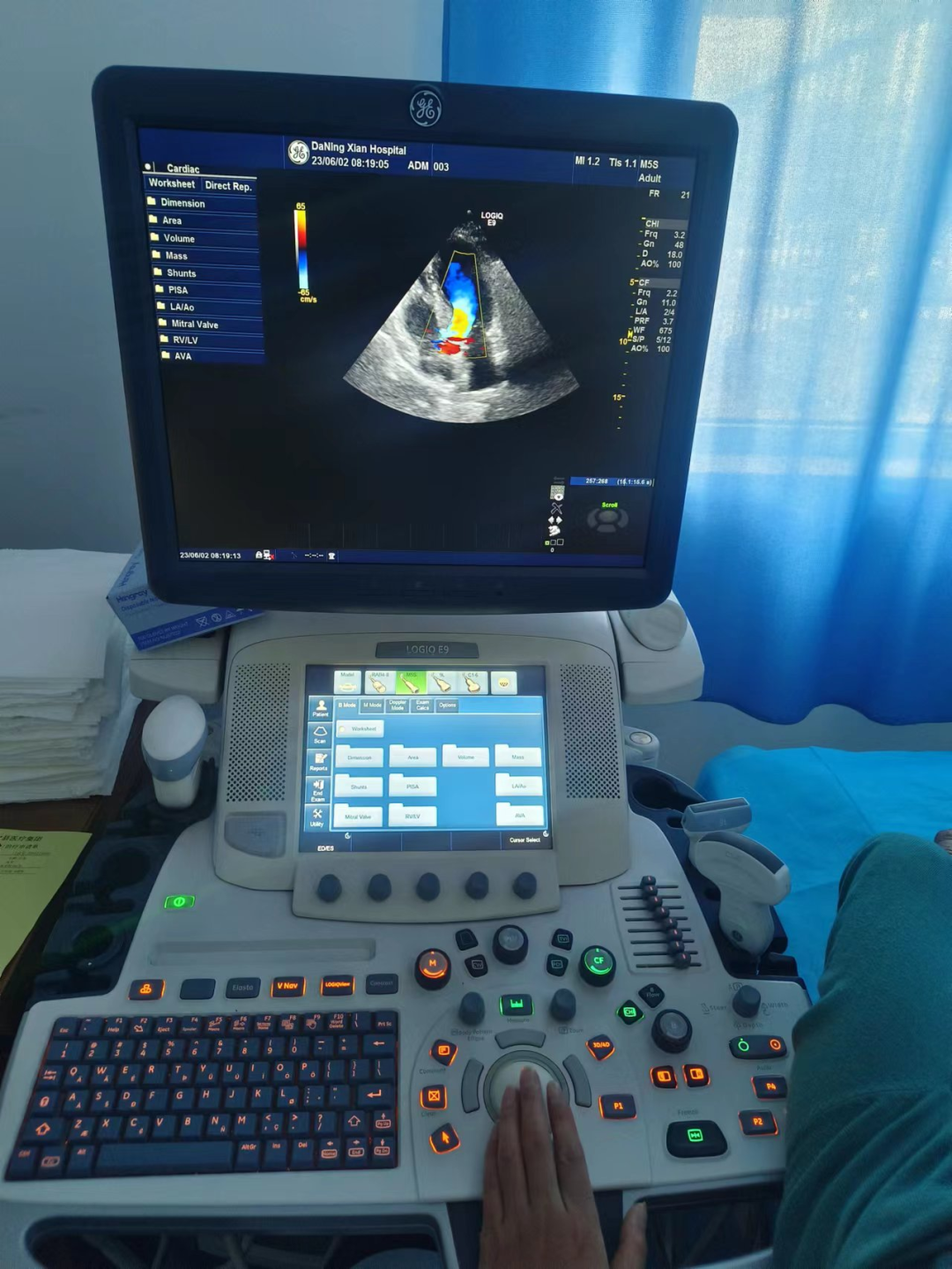 siui彩超怎么用【科室介绍】大宁县人民医院超声科_https://www.jmylbn.com_新闻资讯_第5张