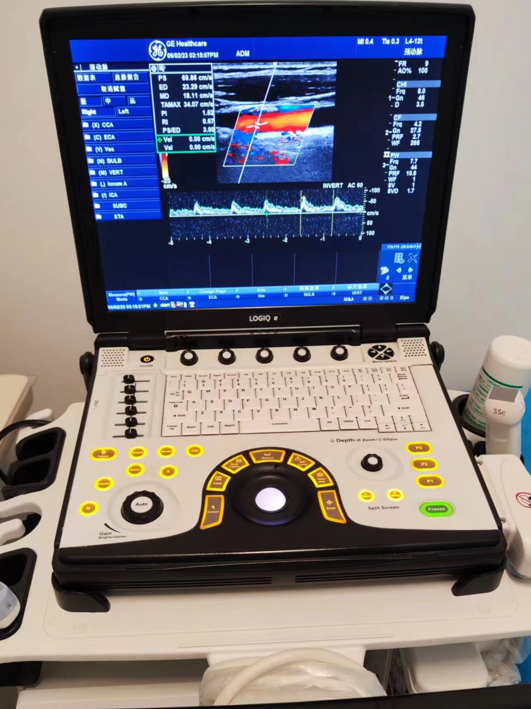 siui彩超怎么用【科室介绍】大宁县人民医院超声科_https://www.jmylbn.com_新闻资讯_第7张