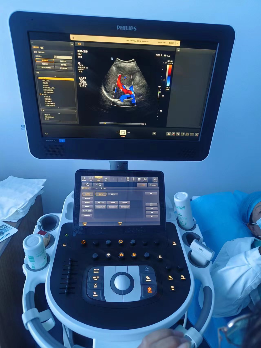 siui彩超怎么用【科室介绍】大宁县人民医院超声科_https://www.jmylbn.com_新闻资讯_第10张