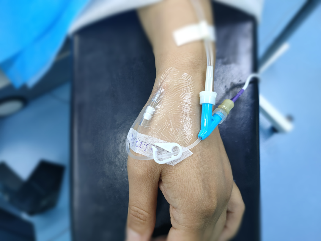 手术中怎么选择针手术室留置针——“针”不一样，“针”有讲究_https://www.jmylbn.com_新闻资讯_第4张