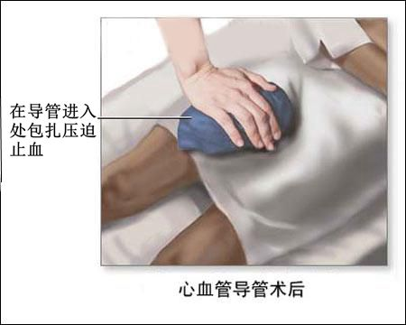 射频什么科【健康科普在附院】什么是心脏射频消融术？_https://www.jmylbn.com_新闻资讯_第10张